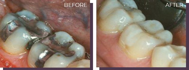 Restoration - Before and After