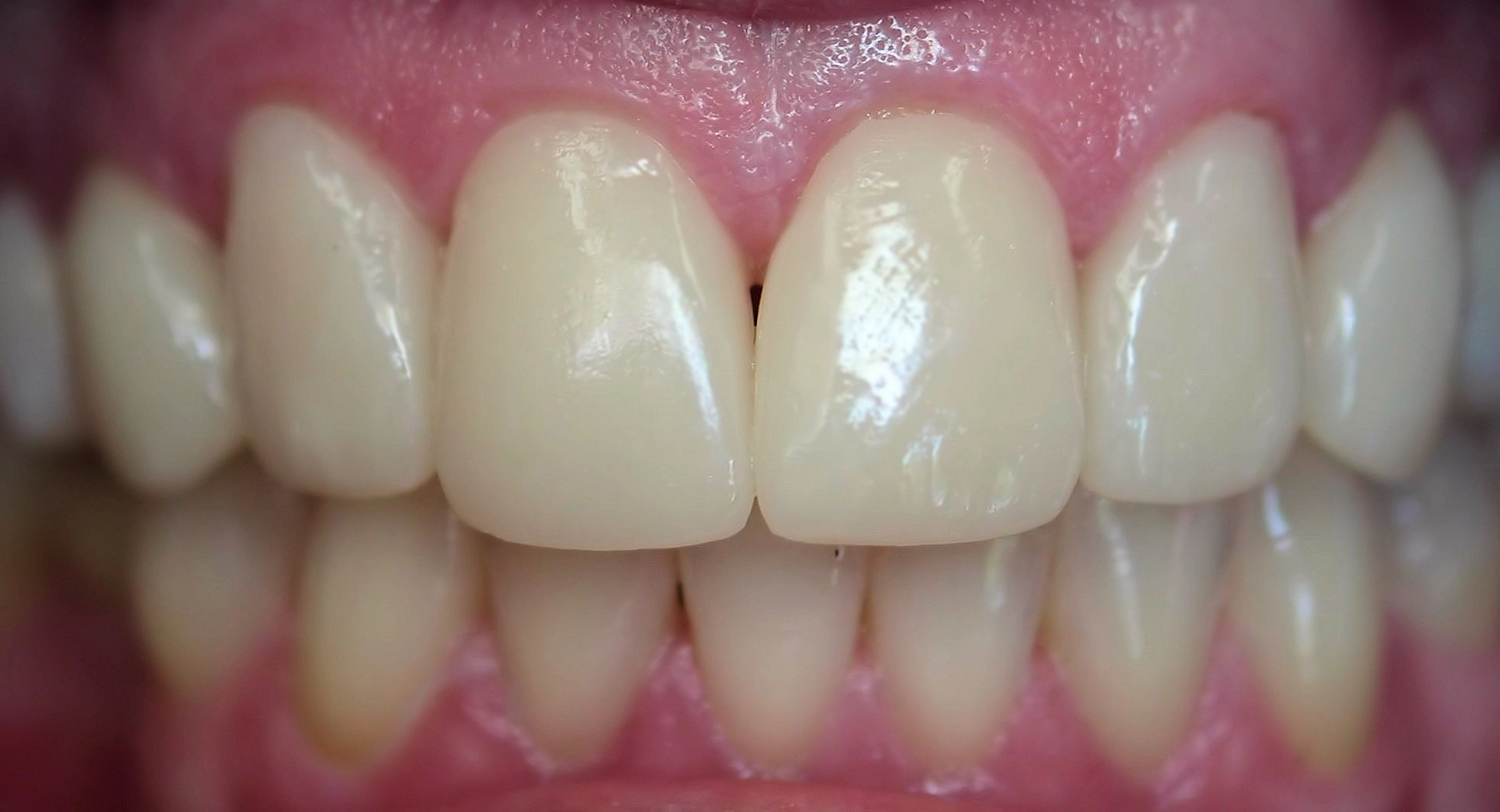 After treatment