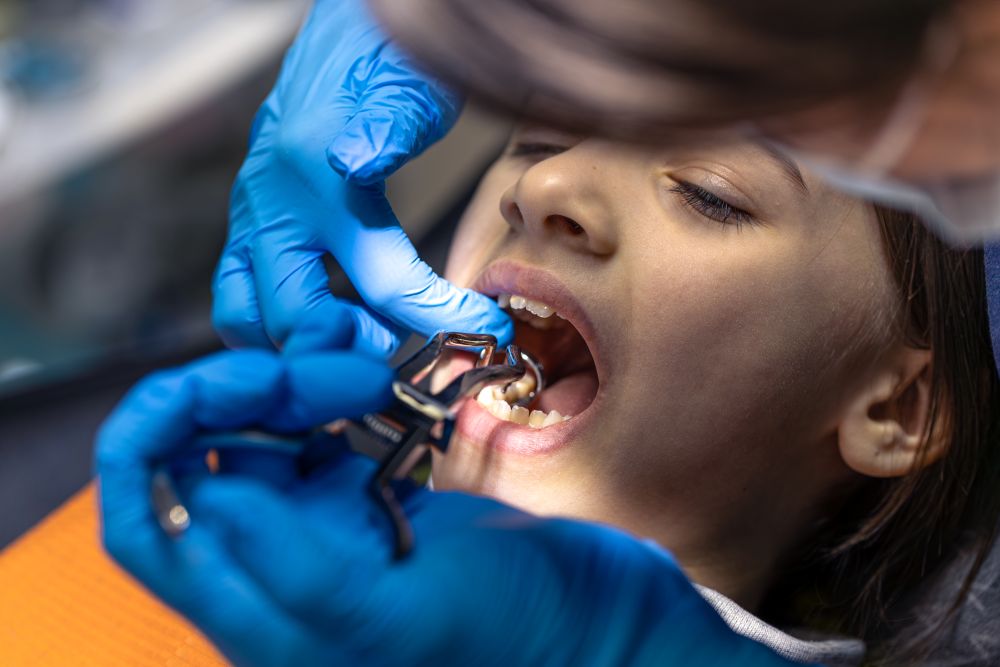 Replacing a Tooth After Extraction