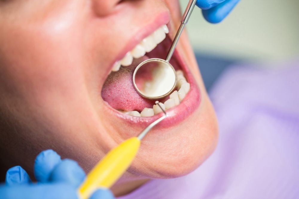 Gum Disease Is Checked at a Dental Visit