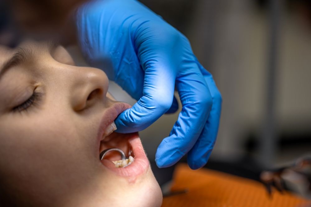 Teeth reshaping cost