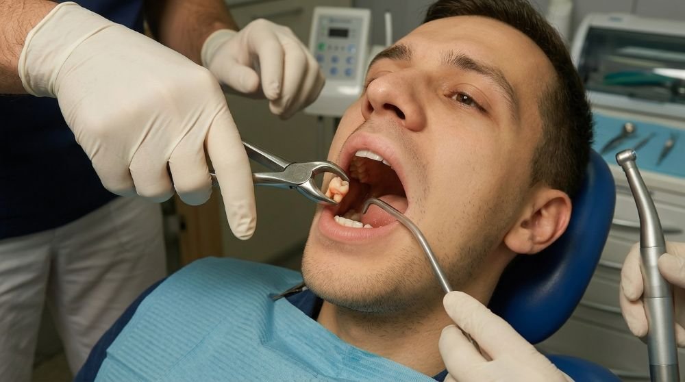 7 Signs Your Wisdom Teeth Need to Be Removed (And When They Don’t)